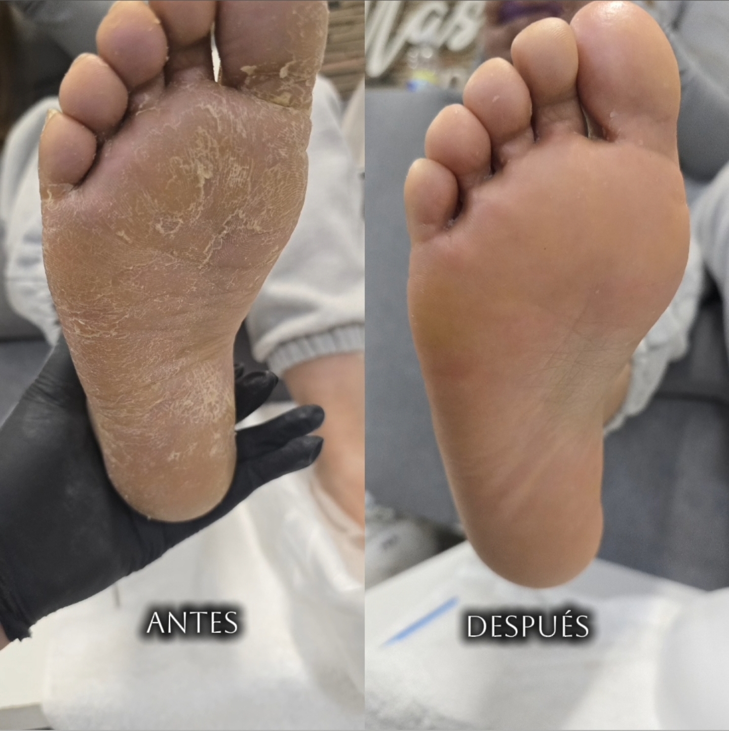 Podoestetica 1